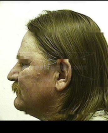 Ronnie Lynn Smith