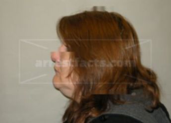 Teresa A Yakes