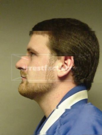 Joshua J Ammeter